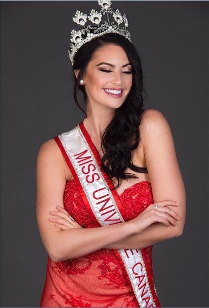 Siera Bearchell Contestant from Canada for Miss Universe 2016 (Photo Credits: Instagram/Facebook Official)
