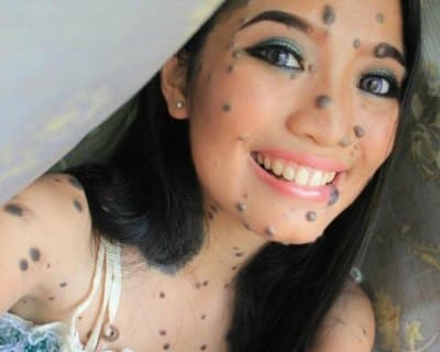 Nothing should be a barrier for you to live your life, proves this Malaysian Beauty