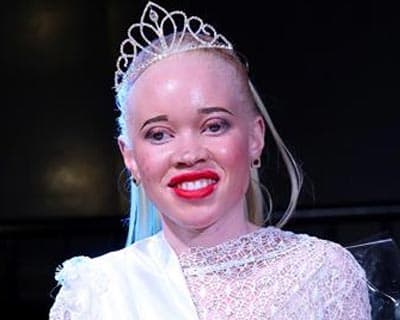 A Look into the World of Albino Beauty Pageants