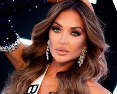 Reigning Miss Belgium Chayenne Van Aarle recovers from serious injuries after car accident