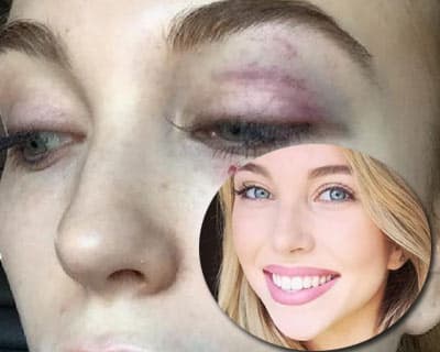 Elise Chambellant Miss Universe Australia Queensland 2016 finalist attacked
